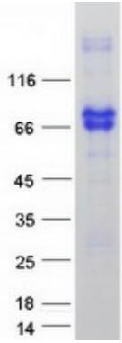 Coomassie blue staining of purified NGFR protein.